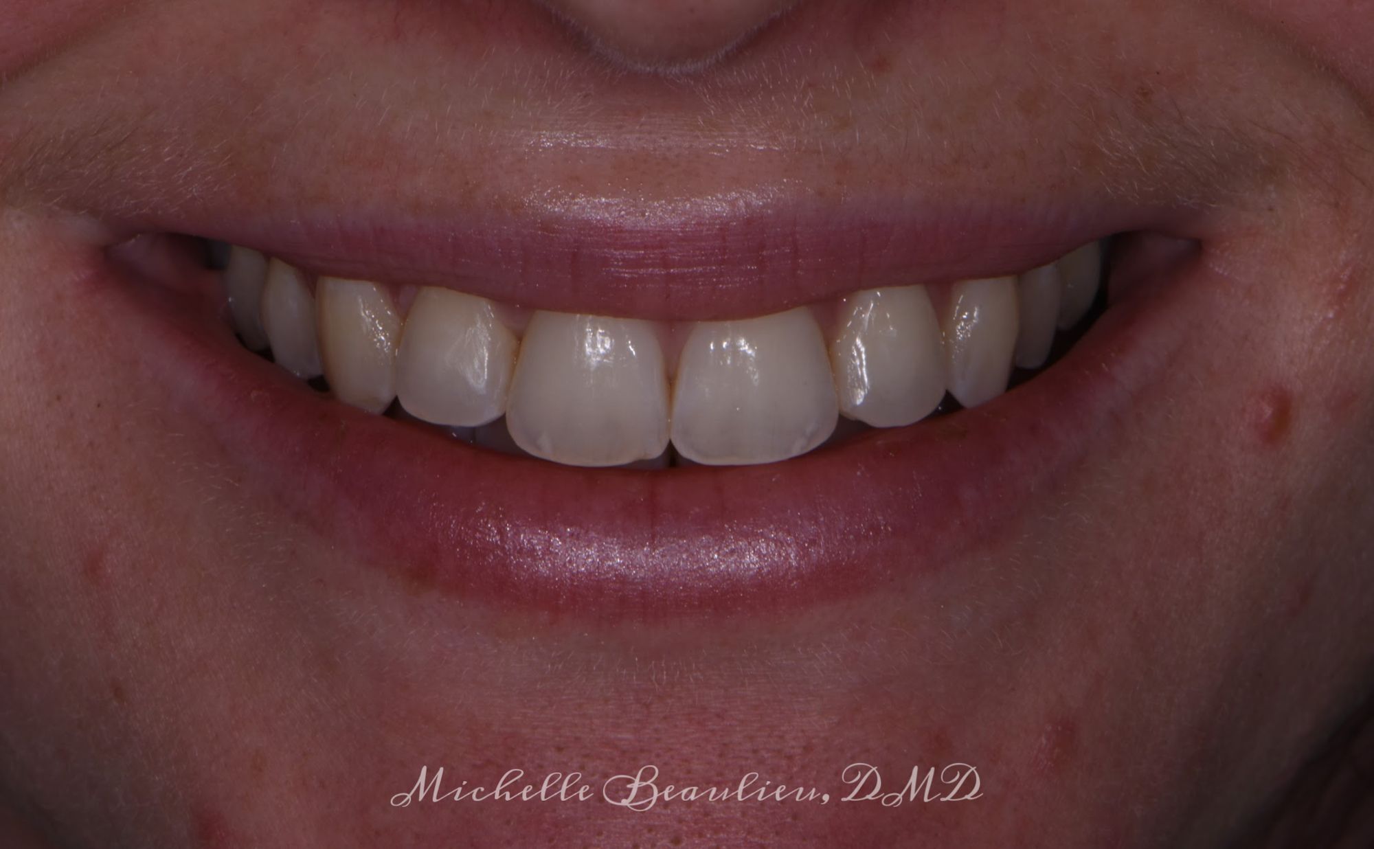 Dr Beaulieu's Work Brightwork Dental Care